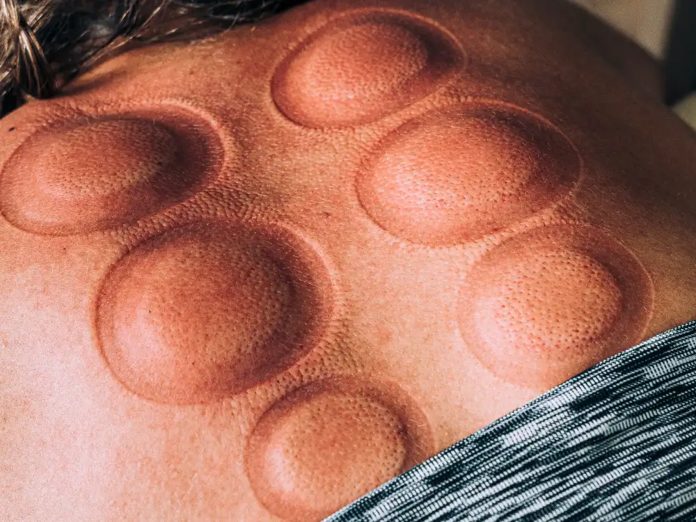 massage ventouses montréal